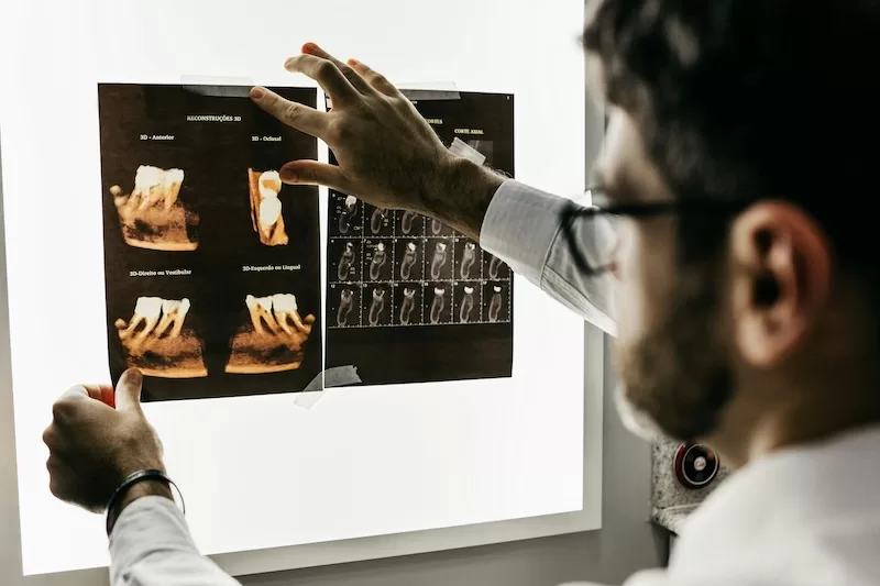 The Hidden Healthcare Question in Every Plan B: What Private Dental Care Can Really Cost Abroad