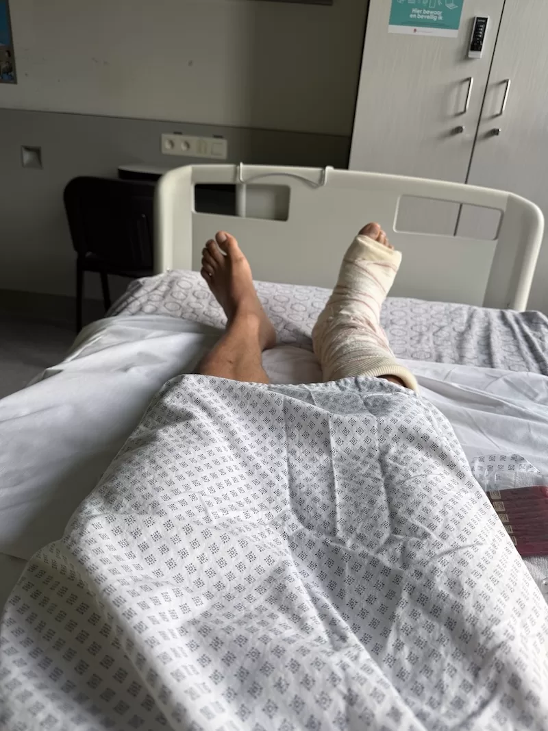 A hospital-bed view of a bandaged foot after surgery, two pins holding the break.